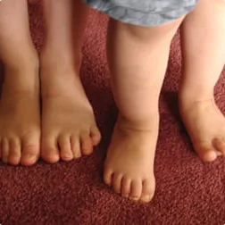 A young child standing barefoot, showing foot position