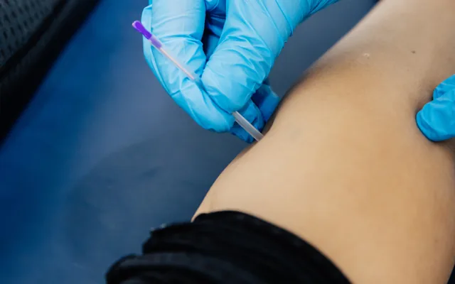 Dry needling being applied to a patient’s lower leg